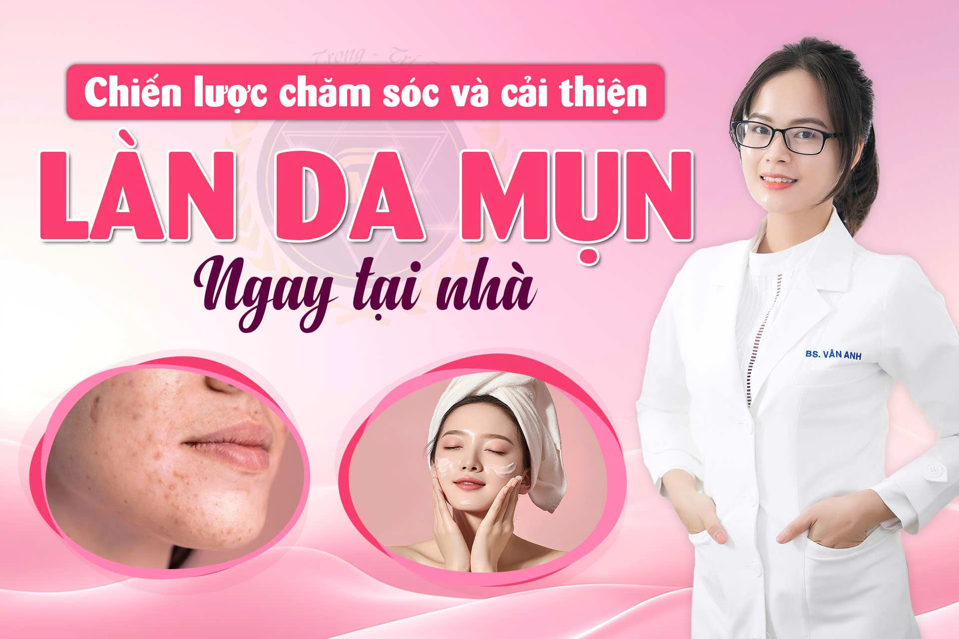 CHIẾN LƯỢC CHĂM SÓC VÀ CẢI THIỆN LÀN DA MỤN NGAY TẠI NHÀ